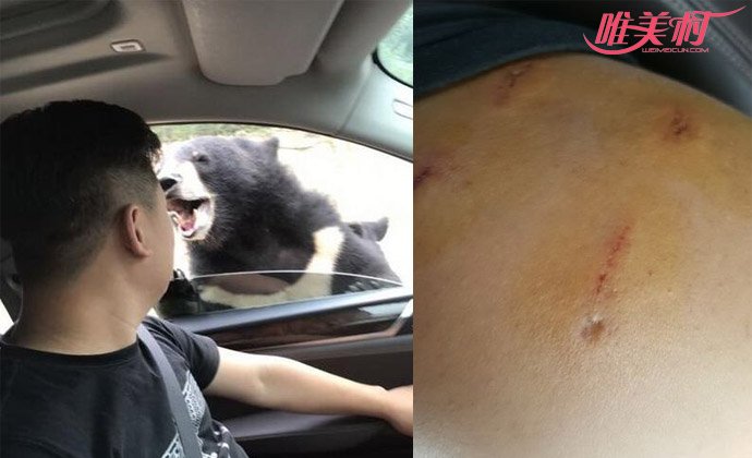 八达岭动物园熊咬伤游客