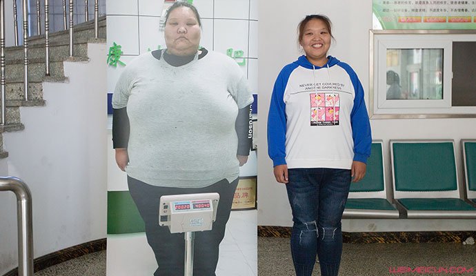 少女半年减190斤