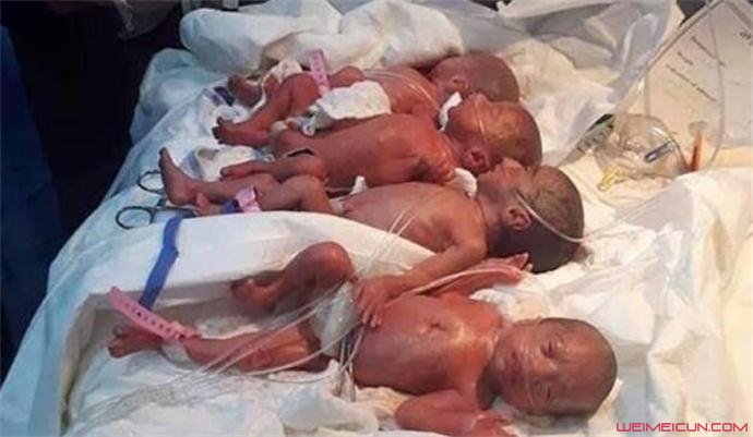 女子顺产7胞胎