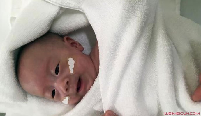 世界最小的男婴出院