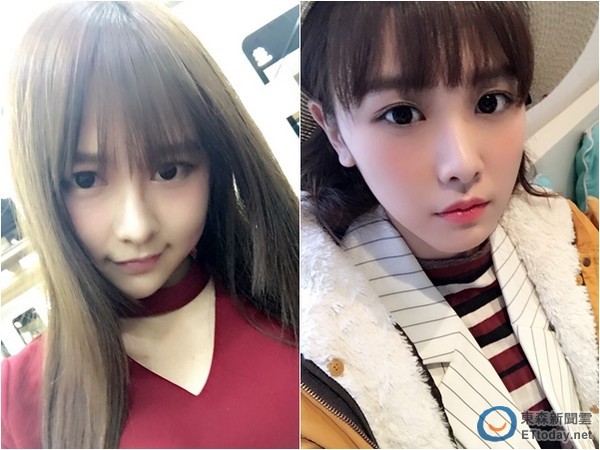 SNH48唐安琪受伤后第3次动刀 “脸部植皮”
