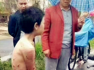 男童雨中裸体被栓车上虐打 暴力父亲引发众