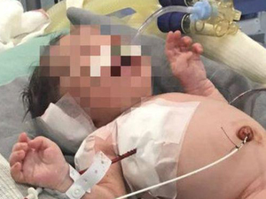 9个月胎儿遭枪击存活 子弹穿臀部子宫击中婴