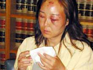 中国女子在美国遇暴力拘捕 身上伤痕累累10